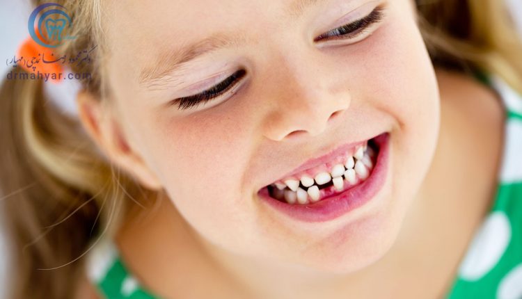 سن افتادن دندان‌های شیری