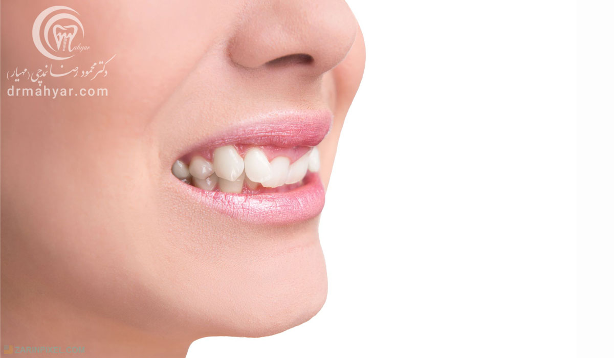 عوارض ناشی از رویش نابجای دندانی