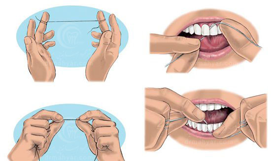 نحوه استفاده صحیح از نخ دندان